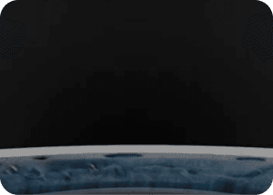 CATALYSレーザーによる精密水晶体嚢切開