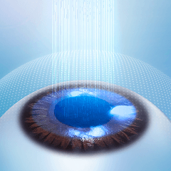 レーザー視力矯正